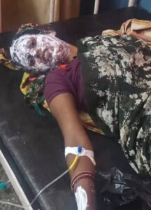 बंडा में गैस सिलेंडर से लगी भीषण आग, नकदी समेत हजारों का सामान राख; महिला झुलसी