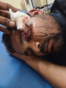 पिनाहट में दुकानदार पर चाकू से जानलेवा हमला, आंख फोड़ी, गल्ले से 10 हजार लूटे
