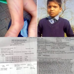 गोण्डा:होमवर्क न करने पर करनैलगंज के निजी स्कूल के अध्यापक ने कक्षा 2 के छात्र को मारे 105 डंडे, एफ आई आर दर्ज