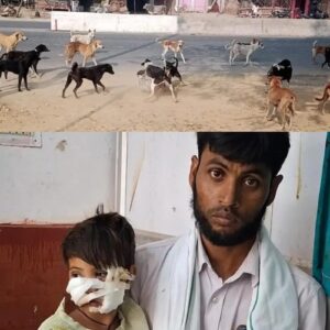 बच्ची के चेहरे को कुत्ते ने जबड़े में जकड़ा: बाराबंकी में बच्चों के चेहरे पर लगे 40 टांके, घर के बाहर खेलते समय बच्चों पर किया कुत्तों ने हमला
