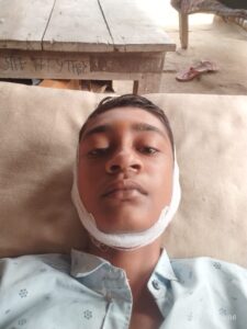 सांड के हमले में 15 वर्षीय बालक गंभीर घायल  रिपोर्ट अनिल यादव मव‌ई अयोध्या